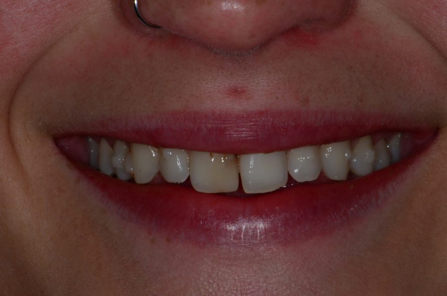 i smile dental care queens new york photos